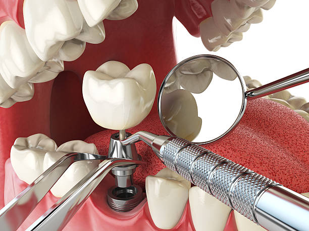 Best Emergency Dental Care for Sports Injuries in Warren, IL